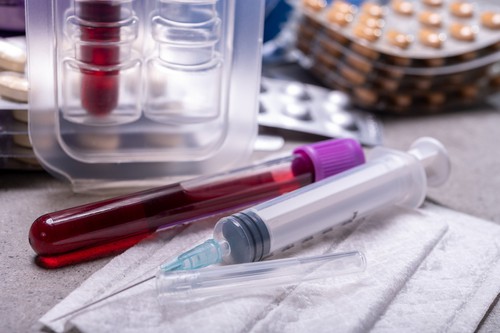 Can You Be Convicted of a DUI Without a Blood Test? | Law Offices of ...